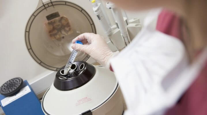 Фото:  спермограмма вязкость повышенна